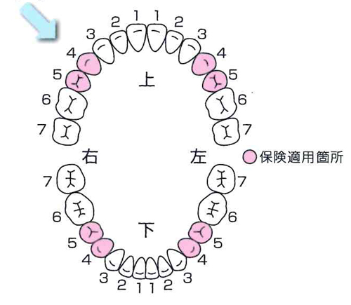 健康保険が適用される部位はコチラ