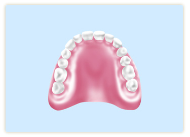 コンフォート（自由診療のやわらかいシリコン義歯）
