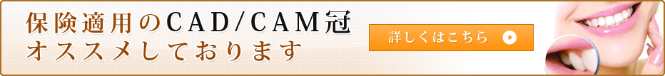 保険適用のCAD/CAM冠 オススメしております