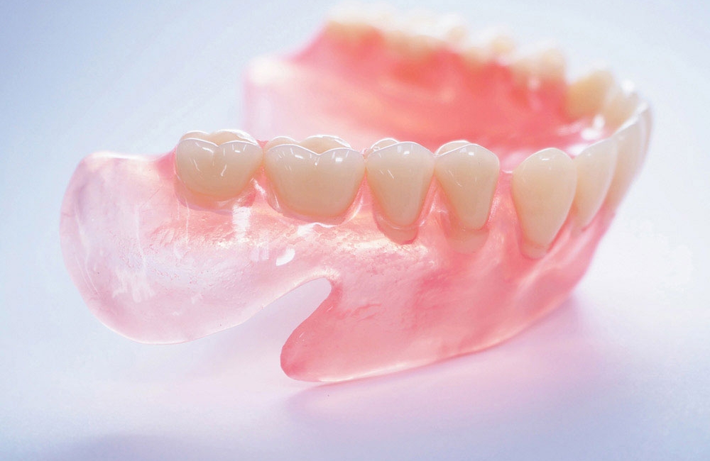 レジン床義歯　(保険の入れ歯)