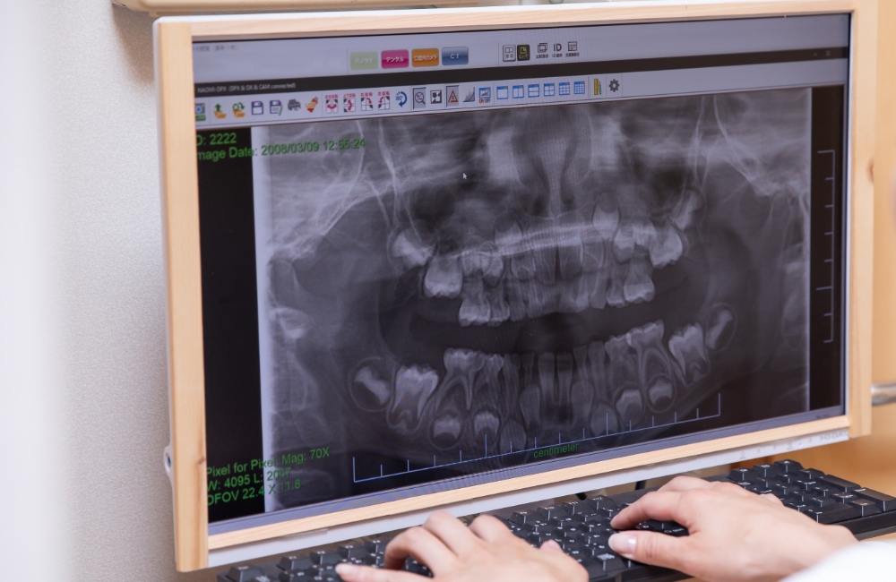 ガイデッドサージェリーとは