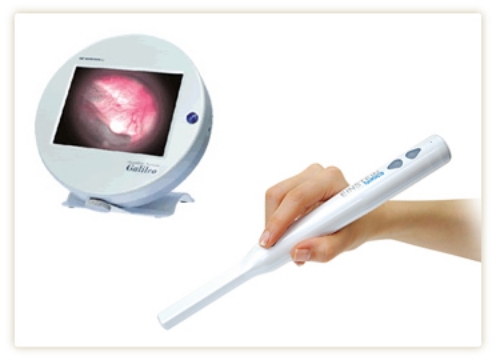 口腔内カメラとモニター画像
