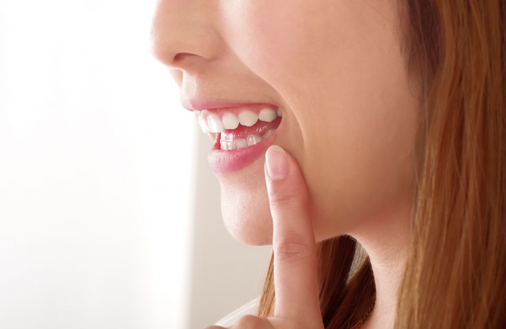 セラミック製の固定装置